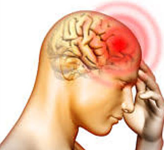 Tipos de Cefaléia e Tramentos pela Acupuntura – Parte&nbsp;2