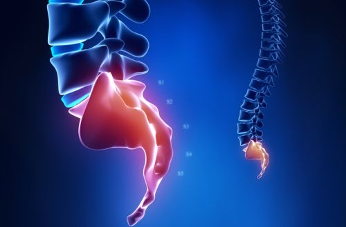 Sacralgia – Acupuntura e Agulhamento&nbsp;Seco