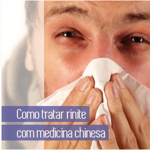 Como aliviar a Rinite usando técnicas da Medicina&nbsp;Chinesa