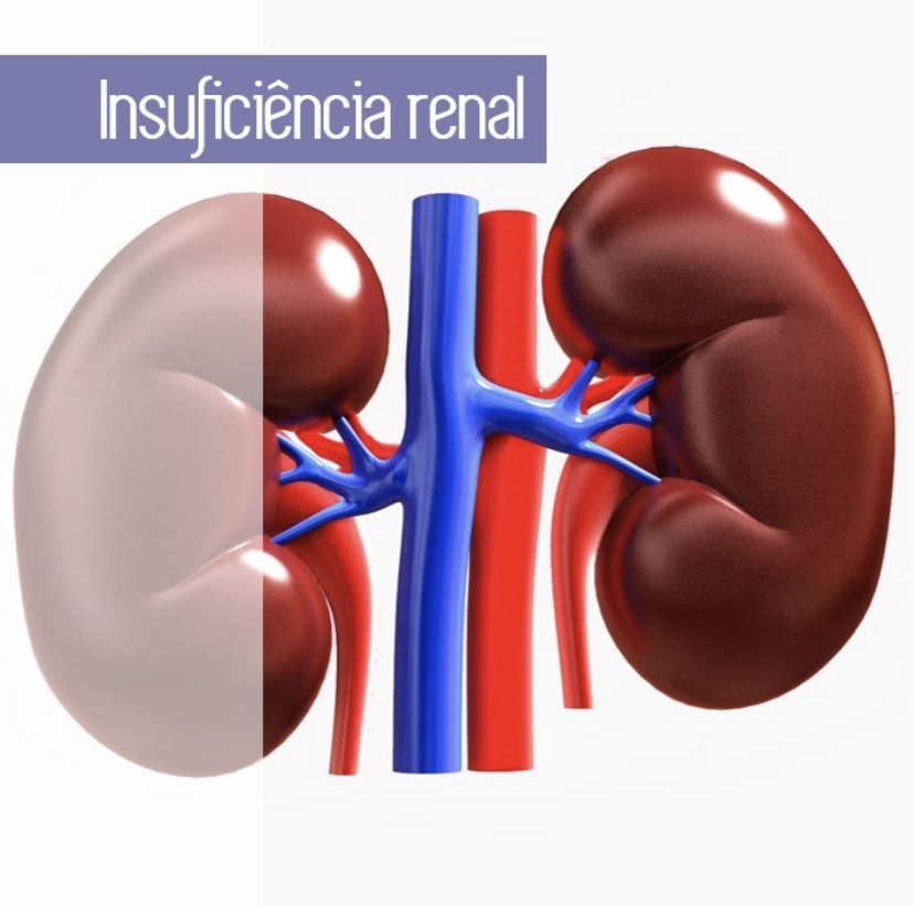 Acupuntura na Insuficiência Renal