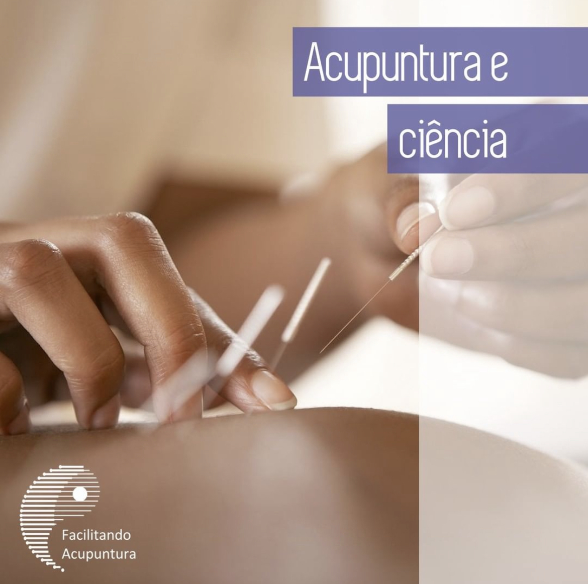 Acupuntura Baseada em Comprovações Científicas
