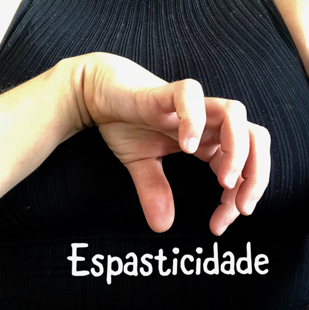 Acupuntura no Tratamento da Espasticidade