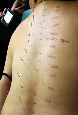 OS ZANG FU – BEXIGA – FISIOLOGIA e&nbsp;PATOLOGIA