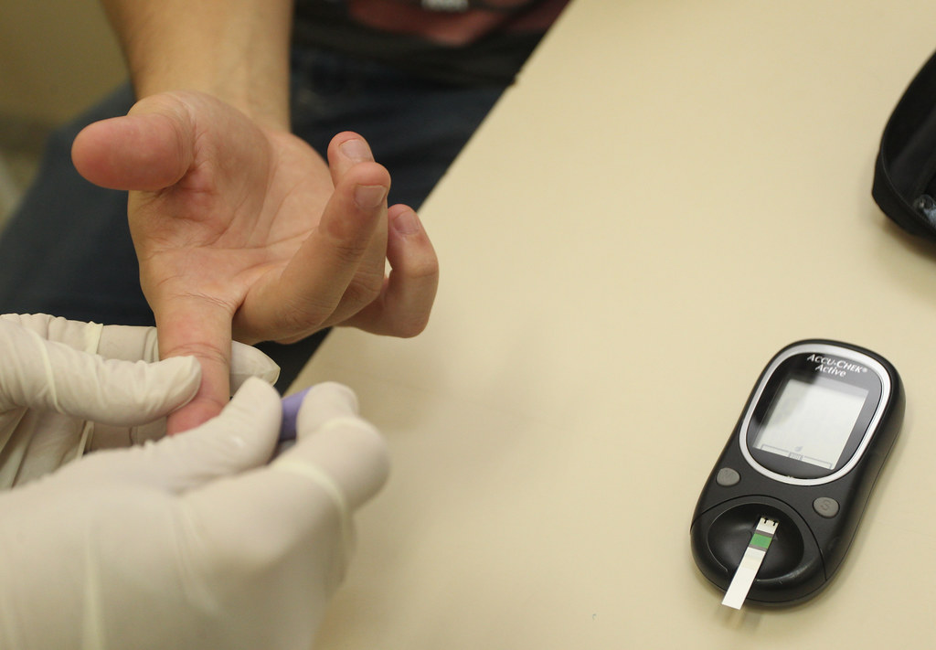 Covid 19 – Diabetes e&nbsp;Acupuntura