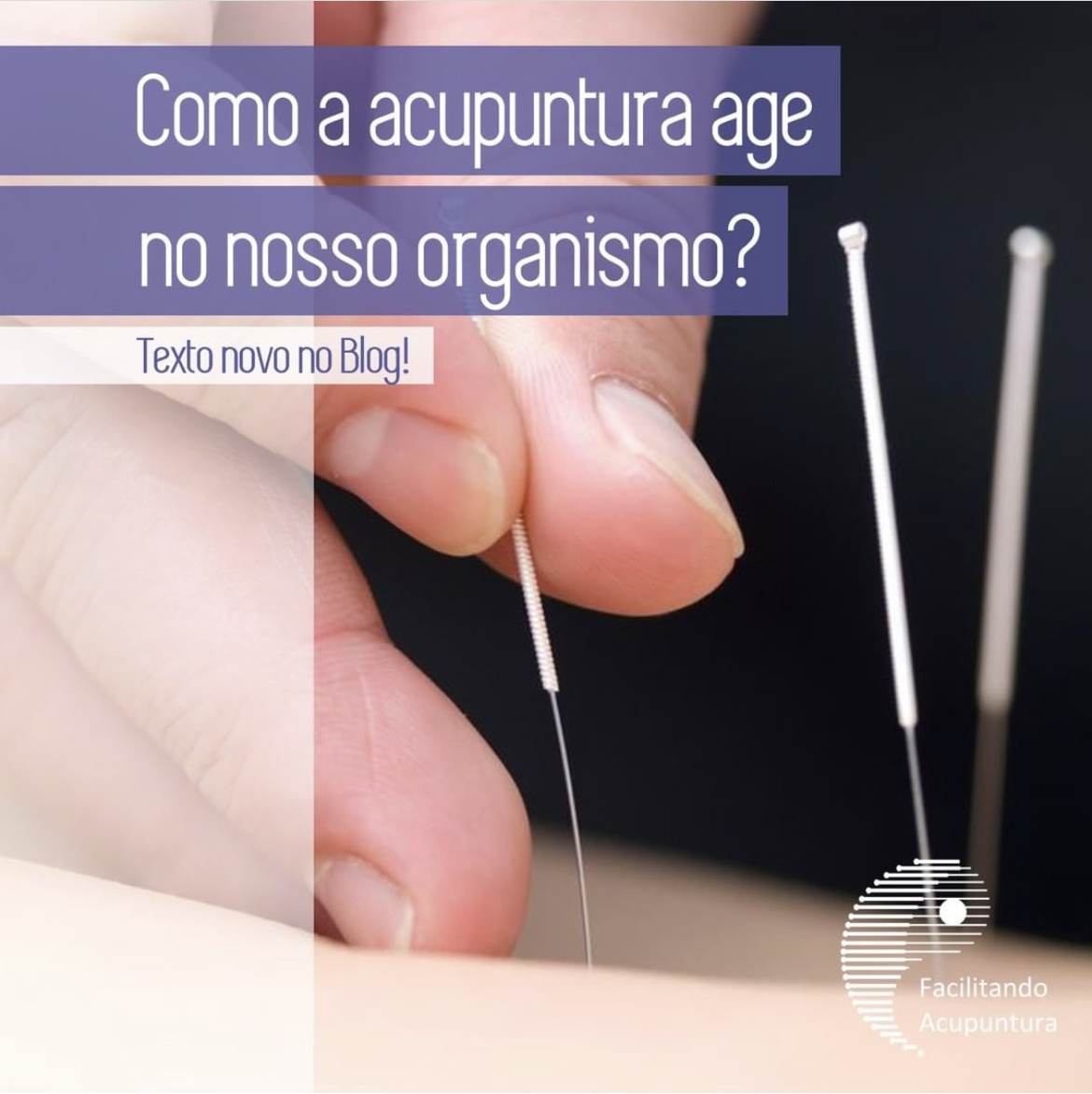 Como a Acupuntura atua na Dor