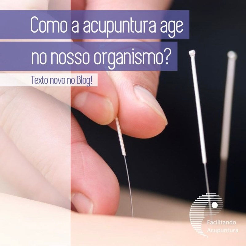 Como a Acupuntura atua na&nbsp;Dor